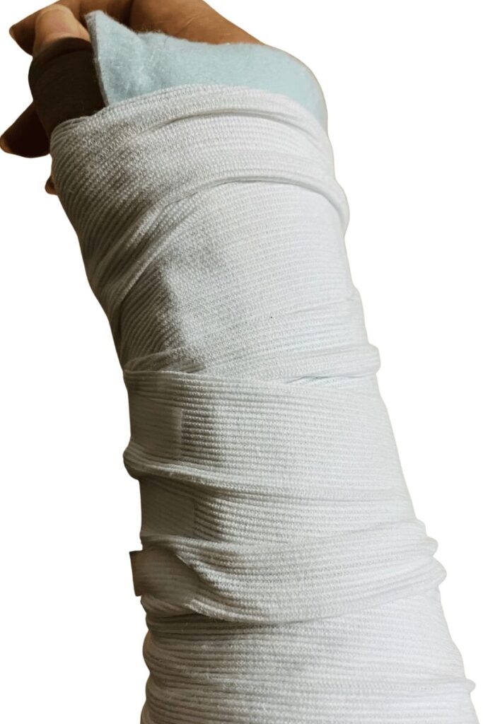 右手首シーネ固定画像